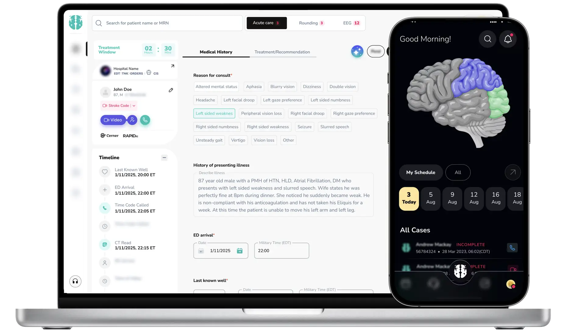 A laptop and iphone showing Synapse AI Teleneurology software on the screens